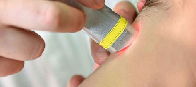 High - Intensity Laser Therapy (Hilt)